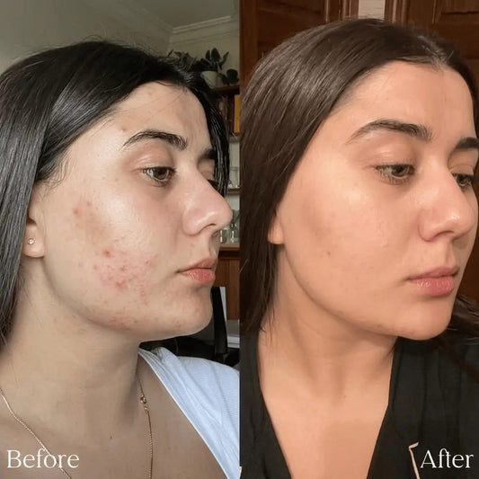 Eco Sonya Super Citrus Cleanser